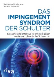 Das Impingement-Syndrom der Schulter | Nicolai Napolski (u. a.) | Taschenbuch | 