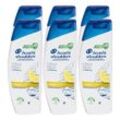 Head & Shoulders Shampoo Citrus Fresh 300 ml, 6er Pack